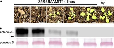 Increased Expression of UMAMIT Amino Acid Transporters Results in Activation of Salicylic Acid Dependent Stress Response